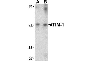 Western Blotting (WB) image for anti-Hepatitis A Virus Cellular Receptor 1 (HAVCR1) (Middle Region) antibody (ABIN1031124) (HAVCR1 antibody  (Middle Region))