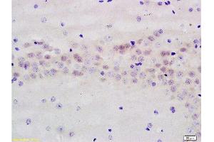 Immunohistochemistry (Paraffin-embedded Sections) (IHC (p)) image for anti-Protein Kinase, AMP-Activated, beta 1 Non-Catalytic Subunit (PRKAB1) (AA 201-270) antibody (ABIN737901)