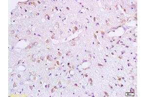 Formalin-fixed and paraffin embedded rat brain labeled with Anti-BCAT1 Polyclonal Antibody, Unconjugated (ABIN718856) at 1:200 followed by conjugation to the secondary antibody and DAB staining. (BCAT1 antibody  (AA 321-386))