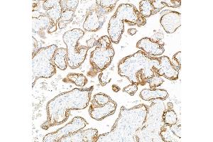 Immunohistochemistry (IHC) image for anti-Epidermal Growth Factor Receptor (EGFR) (AA 1100-1150) antibody (ABIN7795641) (Recombinant EGFR antibody  (AA 1100-1150))