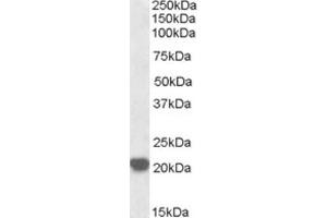 Western Blotting (WB) image for anti-Ras-Related C3 Botulinum Toxin Substrate 2 (Rho Family, Small GTP Binding Protein Rac2) (RAC2) (C-Term) antibody (ABIN2465289) (RAC2 antibody  (C-Term))