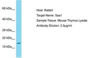 Image no. 1 for anti-Serum Amyloid A1 (SAA1) (AA 51-100) antibody (ABIN6750312) (SAA1 antibody  (AA 51-100))
