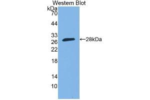 Detection of Recombinant SP140, Human using Polyclonal Antibody to Sp140 Nuclear Body Protein (SP140) (SP140 antibody  (AA 443-655))