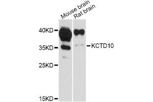 Western blot analysis of extracts of various cell lines, using KCTD10 Antibody (ABIN5998054) at 1:3000 dilution. (KCTD10 antibody)