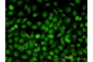 Immunofluorescence of monoclonal antibody to MAPK9 on HeLa cell. (JNK2 antibody  (AA 321-424))