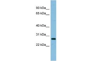 WB Suggested Anti-RPL10A Antibody Titration: 0. (RPL10A antibody  (Middle Region))