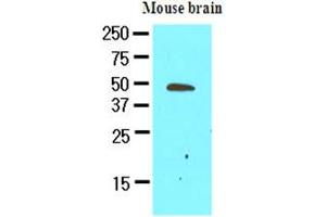 The extracts of mouse brain (50ug) were resolved by SDS-PAGE, transferred to NC membrane and probed with anti-human GAS7 (1:500). (GAS7 antibody)