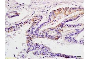 Immunohistochemistry (Paraffin-embedded Sections) (IHC (p)) image for anti-Cancer/testis Antigen 2 (CTAG2) (AA 121-210) antibody (ABIN721135)