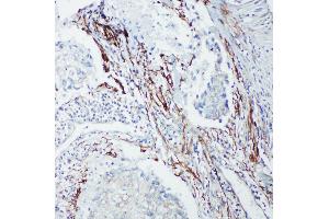 Immunohistochemistry (IHC) image for anti-SHC (Src Homology 2 Domain Containing) Transforming Protein 1 (SHC1) (AA 424-440), (C-Term) antibody (ABIN3044111)