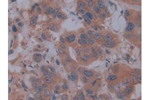 Immunohistochemistry (IHC) image for anti-Fibrillin 1 (FBN1) (AA 246-389) antibody (ABIN7438742)