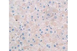 Used in DAB staining on fromalin fixed paraffin- embedded Kidney tissue (CCL26 antibody  (AA 24-94))