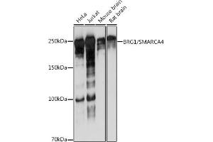 Western blot analysis of extracts of various cell lines, using BRG1/SM antibody (ABIN7270655) at 1:1000 dilution.