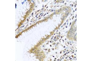 Immunohistochemistry of paraffin-embedded human stomach using TMEM189 antibody at dilution of 1:100 (40x lens). (TMEM189 antibody)
