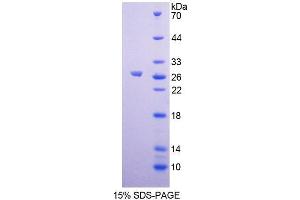 SDS-PAGE analysis of Human GCNF Protein.