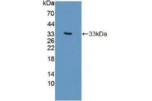 Detection of Recombinant PLCb2, Human using Polyclonal Antibody to Phospholipase C Beta 2 (PLCb2) (Phospholipase C beta 2 antibody  (AA 1-250))