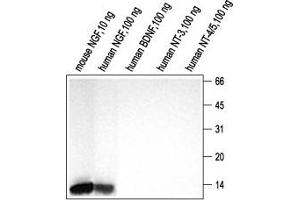 Western blot analysis using Anti-NGF Antibody (ABIN7044627) (1:200). (Nerve Growth Factor antibody  (Intracellular))