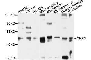 Western blot analysis of extracts of various cells, using SNX6 antibody.