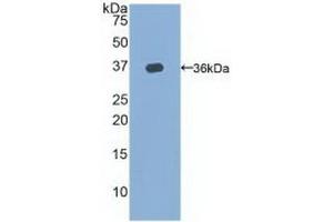 Detection of Recombinant TERT, Rat using Polyclonal Antibody to Telomerase Reverse Transcriptase (TERT) (TERT antibody  (AA 673-976))