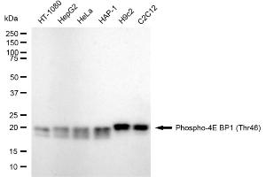 Western blotting analysis using phospho-4E BP1 (Thr46) antibody (ABIN7798530). (Recombinant eIF4EBP1 antibody  (pThr46))
