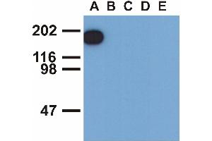 Western blotting analysis of EGFR (phospho-Tyr1173) by mouse monoclonal antibody EM-13 inEGF-treated A431 (A), CALU-3 (B), MCF-7 (C), Jurkat (D) and Ramos (E) cell lines (reduced conditions).
