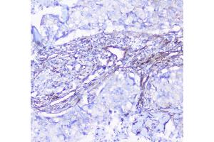 IHC analysis of INPPL1 using anti-INPPL1 antibody (ABIN6719492). (INPPL1 antibody  (AA 1172-1258))