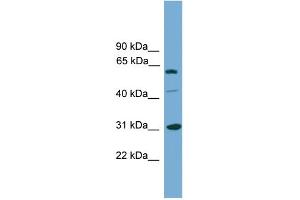 WB Suggested Anti-RAD1 Antibody Titration: 0. (RAD1 antibody  (Middle Region))