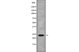 Western blot analysis of RAB15 using RAW264. (RAB15 antibody  (Internal Region))