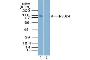 Image no. 1 for anti-Neural Precursor Cell Expressed, Developmentally Down-Regulated 4, E3 Ubiquitin Protein Ligase (NEDD4) (AA 950-1000) antibody (ABIN960275) (NEDD4 antibody  (AA 950-1000))