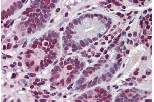 Human Small Intestine: Formalin-Fixed, Paraffin-Embedded (FFPE) (HDAC1 antibody  (AA 1-483))