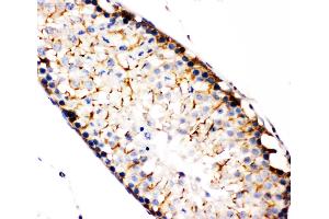 Anti-NAK antibody, IHC(P) IHC(P): Rat Testis Tissue