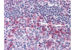 Immunohistochemical analysis of paraffin-embedded human Tonsil tissues using anti-CD69 mouse mAb (CD69 antibody)