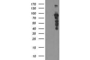HEK293T cells were transfected with the pCMV6-ENTRY control (Left lane) or pCMV6-ENTRY SOX5 (Right lane) cDNA for 48 hrs and lysed. (SOX5 antibody)