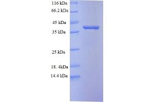 SDS-PAGE (SDS) image for Proprotein Convertase Subtilisin/kexin Type 5 (PCSK5) (AA 117-452) protein (His tag) (ABIN5713716) (PCSK5 Protein (AA 117-452) (His tag))