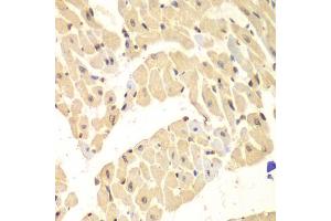 Immunohistochemistry of paraffin-embedded mouse heart using HIF1AN antibody (ABIN5973179) at dilution of 1/100 (40x lens). (HIF1AN antibody)