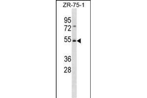 FBXW4 Antibody (C-term) (ABIN1881340 and ABIN2839057) western blot analysis in ZR-75-1 cell line lysates (35 μg/lane). (FBXW4 antibody  (C-Term))