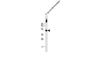Anti-Myc Tag Antibody at 1:2000 dilution + 12 tag recombinant protein lysate Lysates/proteins at 20 μg per lane. (Myc Tag antibody)