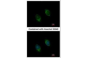 ICC/IF Image Immunofluorescence analysis of methanol-fixed HeLa, using BMP4, antibody at 1:100 dilution. (BMP4 antibody)