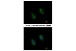 ICC/IF Image Immunofluorescence analysis of methanol-fixed HeLa, using BMP4, antibody at 1:100 dilution. (BMP4 antibody)