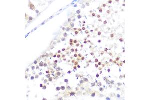 Immunohistochemistry of paraffin-embedded rat testis using NUP50 Rabbit pAb (ABIN6128364, ABIN6144963, ABIN6144964 and ABIN6225005) at dilution of 1:100 (40x lens). (NUP50 antibody  (AA 299-468))