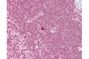 Anti-ZBTB7A antibody IHC of human thymus. (ZBTB7A antibody  (N-Term))