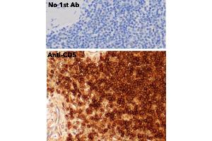 Immunohistochemistry (IHC) image for anti-CD5 (CD5) (AA 105-210) antibody (ABIN7272988) (CD5 antibody  (AA 105-210))