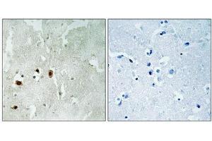 Immunohistochemical analysis of paraffin-embedded human brain tissue using Tip60 (Phospho-Ser90) antibody (left)or the same antibody preincubated with blocking peptide (right). (KAT5 antibody  (pSer90))