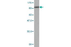 Western Blot detection against Immunogen (75. (ETV6 antibody  (AA 1-452))