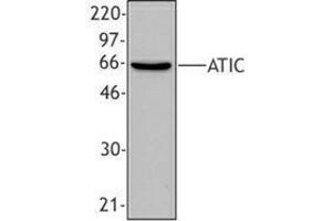 Western Blotting (WB) image for anti-5-Aminoimidazole-4-Carboxamide Ribonucleotide Formyltransferase/IMP Cyclohydrolase (ATIC) antibody (ABIN2666312) (ATIC antibody)