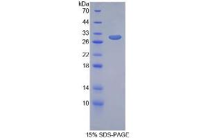 SDS-PAGE analysis of Rat GIF Protein. (Intrinsic Factor Protein)