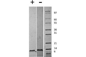 SDS-PAGE of Mouse Stromal Cell-Derived Factor-1 beta (CXCL12) Recombinant Protein SDS-PAGE of Mouse Stromal Cell-Derived Factor-1 beta (CXCL12) Recombinant Protein.