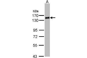 WB Image Sample(30 ug whole cell lysate) A:MOLT4 , 7. (PHF20 antibody  (N-Term))