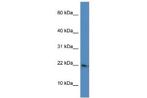 WB Suggested Anti-RPL26 AntibodyTitration: 1. (RPL26 antibody  (C-Term))