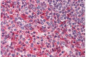 Human Spleen (formalin-fixed, paraffin-embedded) stained with PAK4 antibody ABIN214461 at 2. (PAK4 antibody  (Internal Region))