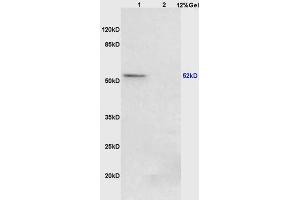 Lane 1: mouse lung lysates Lane 2: mouse stomach lysates probed with Anti Phospho-PPAR Gamma (ser273) Polyclonal Antibody, Unconjugated (ABIN734663) at 1:200 in 4 °C. (PPARG antibody  (pSer273))